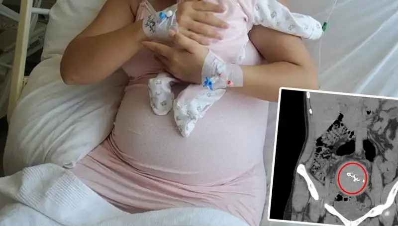 Doğumda Unutulan Bebek: Gazlı Bez İhmalinde Sarsıcı Gelişmeler